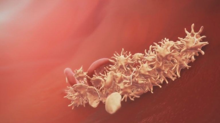 Opracowanie czeka na realizację – horror szczepionkowy i jego konsekwencje trwają